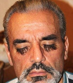 بالصورة.. أوكراني يزعم امتلاكه لأطول رموش في العالم ويحتفظ بالسر 1 اكراني