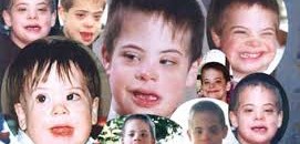 المعاقون ذهنياً.. ظلم الدولة وذوي القربى 10 index.jpg150