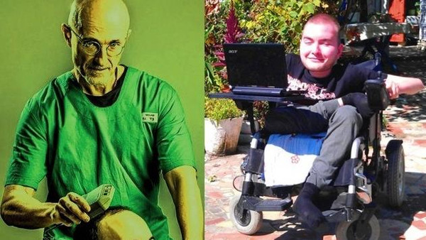 بالصور: جراح إيطالي يقطع رأس رجل روسي ويزرعه بجسد آخر 1 جراح ايطالي