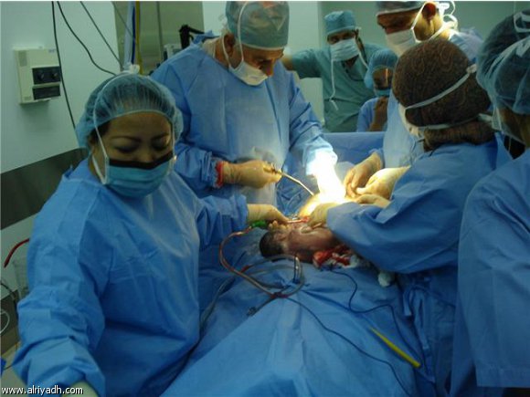 ولادة طفل بلا أنف.. "يتنفس عبر الفم ويتغذى من فتحة بالرقبة" + صورة 1 ولاده