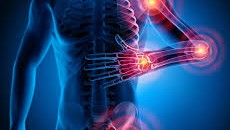 آلام عضوية قد تتجاهلها ولكنها مؤشر لأمراض خطيرة .. إكتشفها 10 آلام عضوية