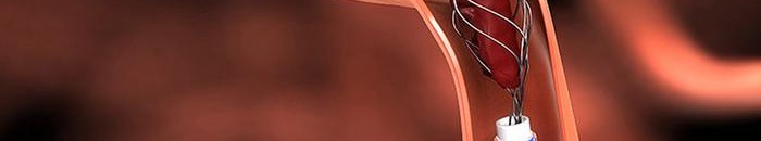 كيف تمكنت سيدة من إنقاذ زوجها المصاب بجلطة دماغية خلال مكالمة هاتفية بينهما! 10 جلطة