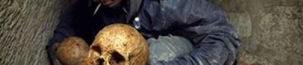 بالصورة: لن تصدّق ما الذي اخترق جمجمة هذا الشاب 11 جمجمة هابيل