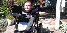 مقعد روسي يبحث عن جسد يزرع عليه رأسه 10 معاق