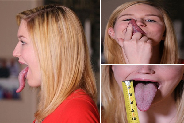 "من كانكر إلى لسان الفراولة".. 5 أسرار يكشفها اللسان عن جسمك 1 اطول لسان