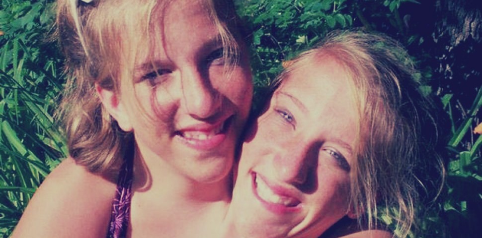 بالصور: توأم مُلتصق بجسدٍ واحد ورأسين.. يتشاركان النمو ويتخاصمان في الأكل والتفكير 1 توأم ملتصق