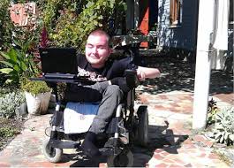 مقعد روسي يبحث عن جسد يزرع عليه رأسه 1 معاق