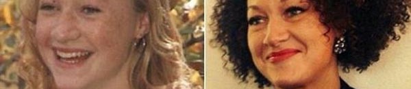 بالصور: امرأة حيّرت العالم ببشرتها.. سوداء أم بيضاء!؟ 20 سوداء أم بيضاء