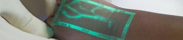 بالصور: جهاز حديث يظهر «وريد» المريض لتسهيل الحقن 15 كاشف الوريد