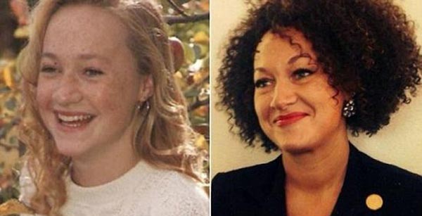 بالصور: امرأة حيّرت العالم ببشرتها.. سوداء أم بيضاء!؟ 1 سوداء أم بيضاء