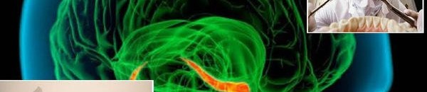 قصة غامضة.. لماذا فَقَدَ مريضٌ ذاكرته خلال جراحة لأسنانه؟ 10 جراحة