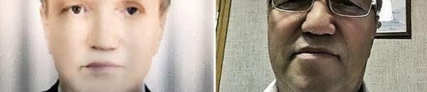 حالة حيرت الأطباء .. روسي يكتسب بشرة سمراء بعد إجرائه زراعة كبد من متبرع إفريقي 10 عملية