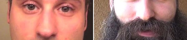 قبل و بعد اللحية
