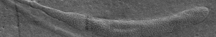 بالصورة: إكتشاف أقدم حيوان منوي في التاريخ بالمصادفة في القطب الجنوبي 11 منوي