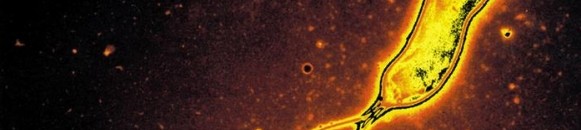 مواد غذائية طبيعية.. وسيلة لمكافحة "جرثومة المعدة" 10 elbashayer image 1435762056