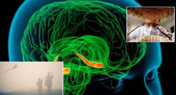 قصة غامضة.. لماذا فَقَدَ مريضٌ ذاكرته خلال جراحة لأسنانه؟ 1 جراحة