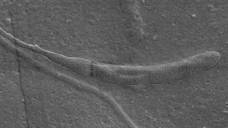 بالصورة: إكتشاف أقدم حيوان منوي في التاريخ بالمصادفة في القطب الجنوبي 1 منوي