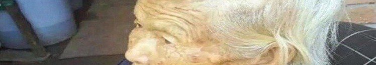 بالصورة .. بعدما زاد عن حده .. اضطر إلى استئصال “قرن الشيطان”! 10 المرأة وحيد القرن