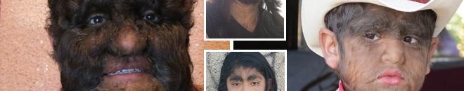 من العالم كيف يعيش الرجل "الأكثر شعرا" في العالم؟ 10 عائلة المشعرين