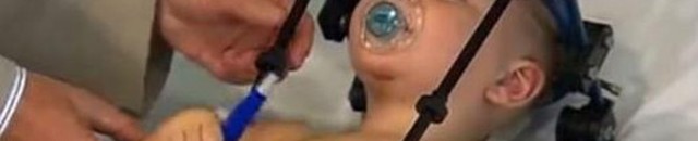 في حالة نادرة.. امرأة في غيبوبة منذ 4 أشهر تضع مولوداً 10 إعادة رأس رضيع