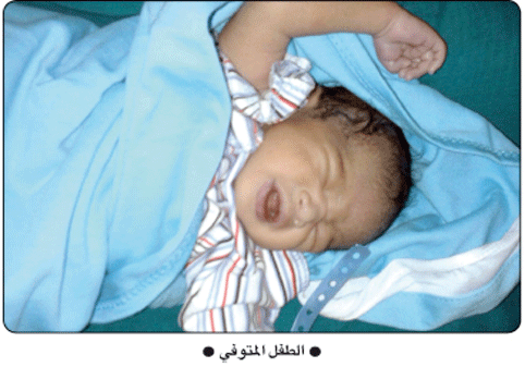 اهمال طبي يؤدي لوفاة طفل بعد ساعات من ولادته 1 114102015