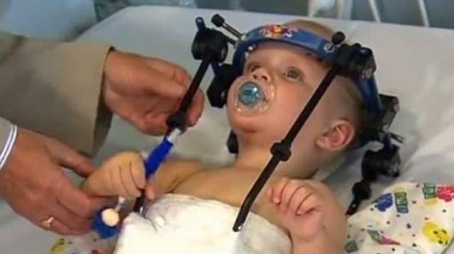 في حالة نادرة.. امرأة في غيبوبة منذ 4 أشهر تضع مولوداً 1 إعادة رأس رضيع