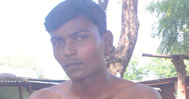 شاب هندي قلبه ينبض خارج جسمه