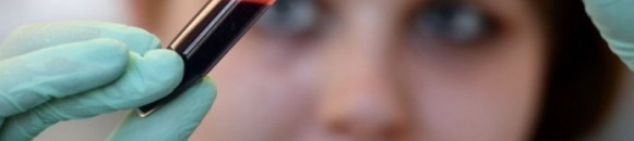 علامات قد تدل على الإصابة بسرطان الدم 10 elbashayer image 1446575913