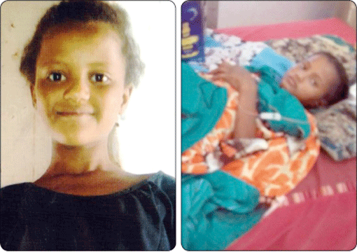 حدث لا يصدق: امرأة وابنتها تقومان بحرق طفلة صماء بالبنزين 1 حادث