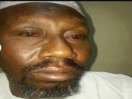 بوابة القاهرة: قصة تعذيب "زكريا" داخل قسم عابدين تثير أزمة في السودان 1 زكريا