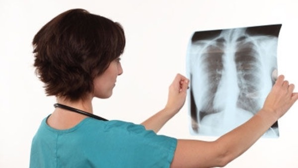 السل خطير جدًا .. وهذا ما لا تعرفونه 1 مرض السل