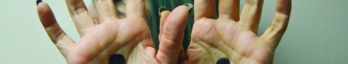 بالفيديو .. داعية مصري: لا أحمل المرأة مسؤولية التحرش حتى لو خرجت “عارية” 10 نقطة سوداء على اليد