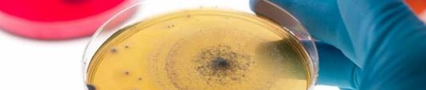 ماذا تعرفون عن بكتيريا السعادة؟ 10 2655474797 227155 large