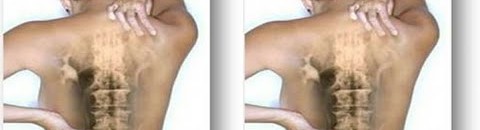 معالج شعبي يستخرج خيوط من ظهر مريض 10 12744952