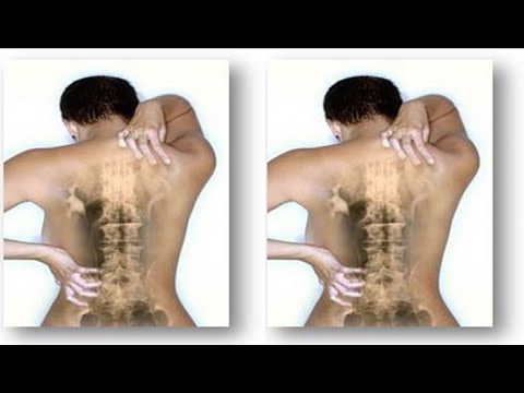 معالج شعبي يستخرج خيوط من ظهر مريض 1 12744952