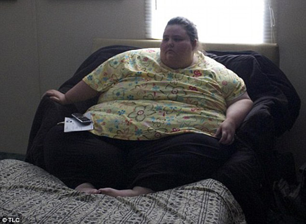 امرأة فقدت 240 كيلو من وزنها فكيف أصبحت؟ 1