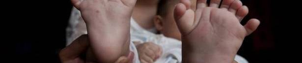 طفل صيني ولد بـ 31 إصبعاً