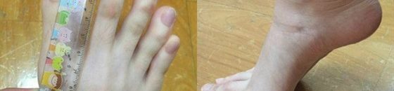فتاة تثير ضجة على الإنترنت بسبب أصابع قدميها الطويلة