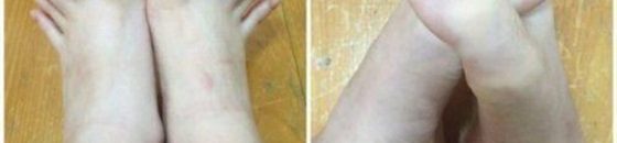 (اللصقة العجيبة ).. بيع الوهم في شوارع الخرطوم 10 فتاة تثير ضجة على الإنترنت بسبب أصابع قدميها الطويلة1