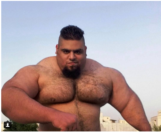 شاهد صور رجل يتحول إلى جسم حقيقي عن طريق حقن عضلاته بزيت النايلون