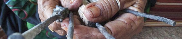 بالفيديو.. طريقة علاج غريبة.. معالج شعبي يضع أصابعه داخل حلق شخص مريض 10 1311 firecure005 6328 990