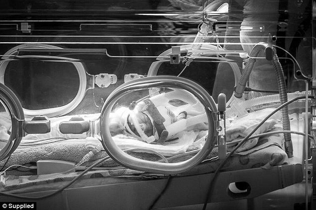 أطباء مصريون يصدمون بعد “ولادة نادرة” تحدث كل 500 ألف حالة! 1 35932CDA00000578 3655509 The baby boy inside his incubator at the hospital He was born wi a 6 1466663063234 170994