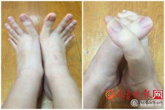 فتاة تثير ضجة على الإنترنت بسبب أصابع قدميها الطويلة1