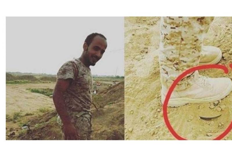 شاهد بالصورة .. كيف أُنقذ هذا الجندي السعودي من الموت بعدما داس على لغم ؟ 2 كيف أُنقذ هذا الجندي السعودي من الموت بعدما داس على لغم ؟