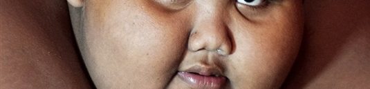 بالفيديو.. أسمن طفل في العالم يذهب للمدرسة سيرا على الأقدام 10 «أسمن» طفل في العالم3