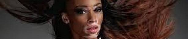 بالفيديو .. فتاة مشوهة الوجه بـ«مية نار» تشارك في عرض أزياء عالمي 10 عارضة أزياء مريضة تخطف الأنظار في أسبوع الموضة بباريس4