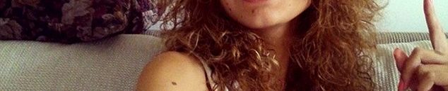 بالصور.. زهراء الساهر قصة فتاة مغربية أصبحت نجمة مواقع التواصل 12 فتاة جميلة تمتلك جسما مغطى بالوحمات تتغلب على سخرية الناس1