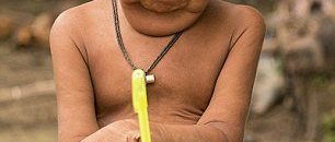 بالصورة .. حالة نادرة .. طفل يبيض كالدجاج ويحير الأطباء 11 720163010541349836B43E3D00000578 0 image a 10 1469803426202 1