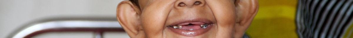 بالصورة .. عمره 34 عاما لكنه يبدو طفلا .. وهذا حلمه 11 طفل