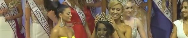 بالصورة.. قصة «أنحف امرأة في العالم»: هوس «الدايت» حوّلها من ملكة جمال إلى هيكل عظمي 11 Capture1247